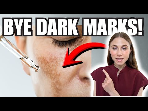 Видео: Гексилрезорцин от гиперпигментации: работает ли он?