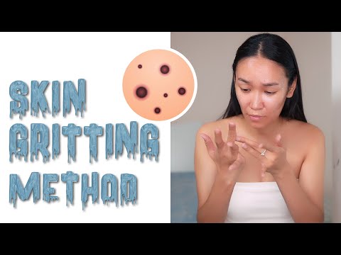 Видео: SKIN GRITTING METHOD | Хар батга хайлуулах арга | HASGOO QN