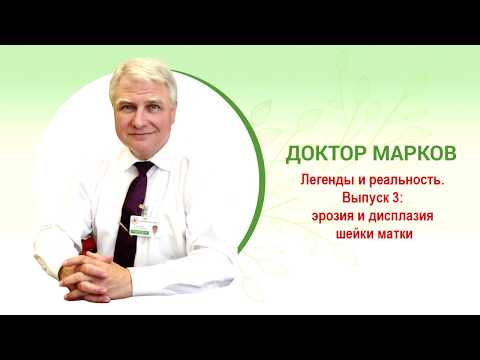 Видео: 🔮Легенды и реальность (выпуск 3): эрозия и дисплазия шейки матки #эрозия