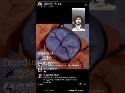 Видео: Избирательное пришлифование