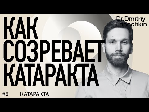 Видео: У Вас в глазу созрела катаракта? Смотрите 4 стадии помутнения хрусталика. Доктор Дмитрий Лапочкин