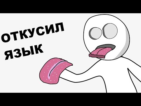 Видео: Мои Детские Травмы (анимация)