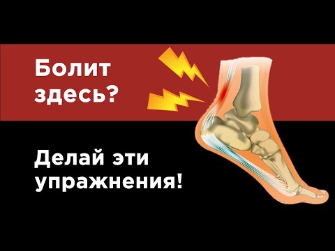 Видео: Как убрать боль в ахилловом сухожилии?