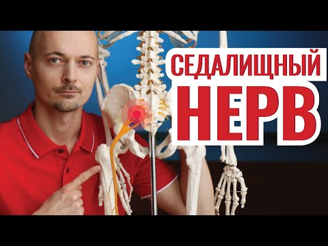 Видео: РАЗБЛОКИРУЕМ СЕДАЛИЩНЫЙ НЕРВ⚡ и устраняем боль за 2 минуты!