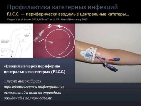 Видео: Катетер-ассоциированная инфекция     Кузьков В.В.