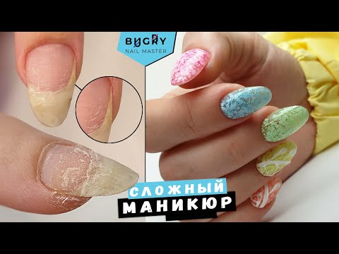 Видео: ОНИХОЛИЗИС ? МАНИКЮР ДВЕ ФРЕЗЫ + НОЖНИЦЫ #ТатьянаБугрий