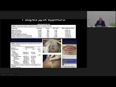 Видео: Лапаротомия  часть 1 Егиев В.Н.