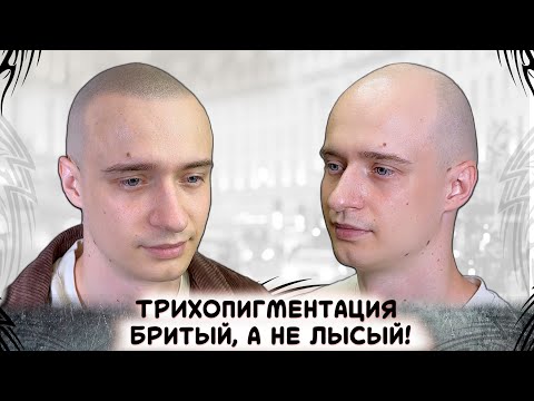 Видео: Трихопигментация в Москве. Бритый а не лысый! Лучше чем пересадка  SMP Scalp Micropigmentation.