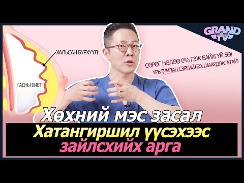 Видео: ГРАНД ГОО САЙХНЫ ЭМНЭЛЭГ - Хөхний мэс заслын дараа анхаарах зүйл