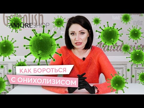 Видео: Онихолизис (Отслоение ногтей) | Причины появления | Как бороться с онихолизисом | Ксения Чумак