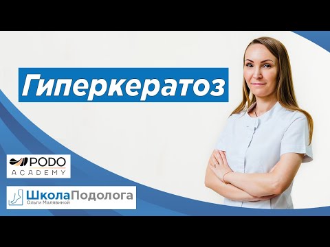 Видео: Гиперкератоз кожи. Подология. Ортониксия.