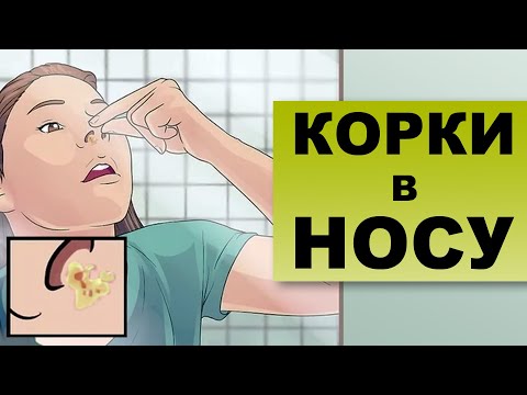 Видео: КОРКИ В НОСУ