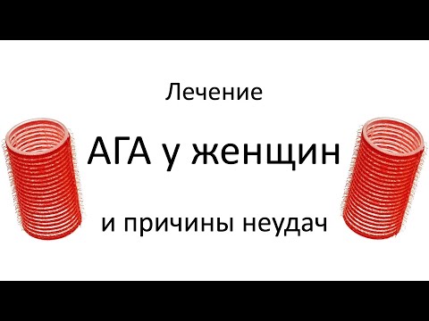 Видео: Лечение Андрогенетической алопеции у женщин