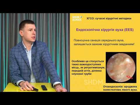 Видео: Майстер-клас «Хронічний середній отит у дітей: сучасні хірургічні методики»