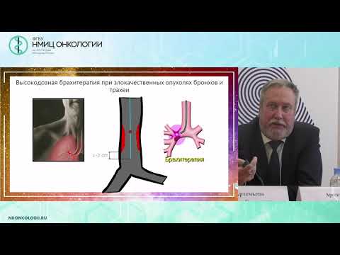 Видео: Современные возможности и перспективы лучевой терапии при немелкоклеточном раке легкого