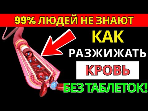 Видео: 🩸 5 простых действий для чистой крови / ИНАЧЕ сосуды забьются! | Старшее здоровье