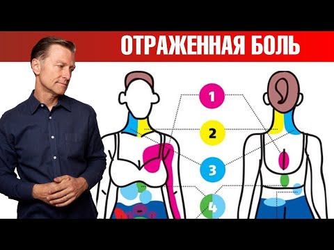 Видео: Отраженная боль 👉 что болит на самом деле?