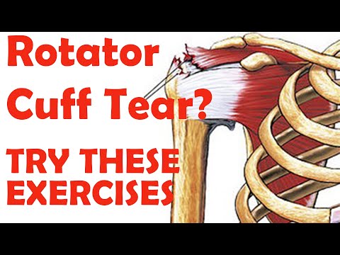 Видео: Упражнения при разрыве вращательной манжеты плеча