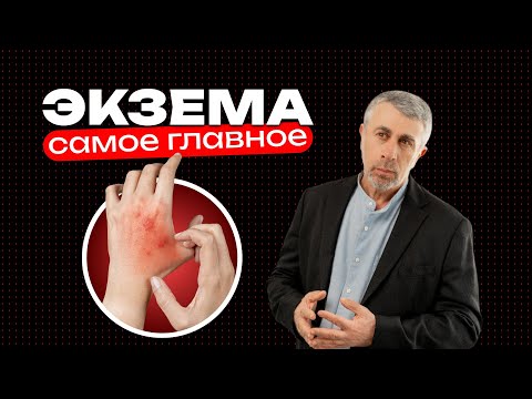 Видео: Экзема. Самое главное