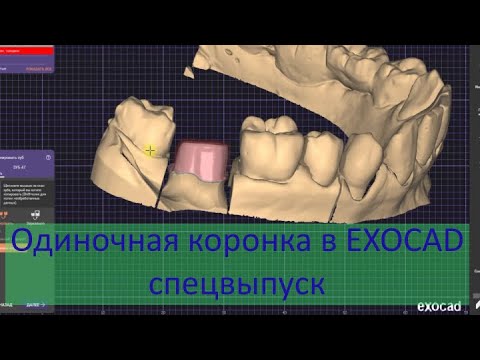 Видео: Одиночная коронка в exocad от А до Я. Спец выпуск.