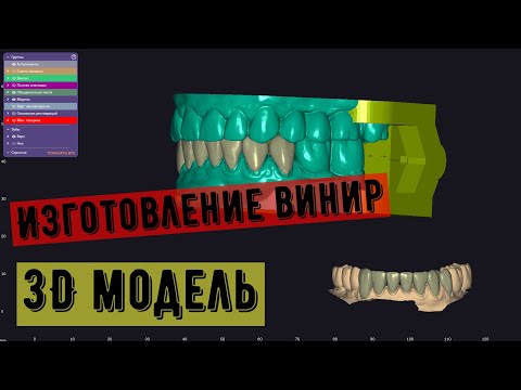 Видео: виниры в экзокаде. цифровая модель. работа с уровня внутриротового скана! 1й этап!