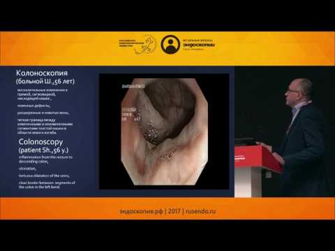 Видео: Ишемический колит