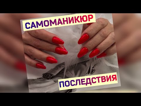 Видео: Маникюр Самой Себе. Что Делать Мастеру с этим "Счастьем"?. Выравнивание Клюющих Ногтей.