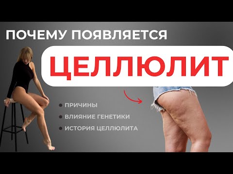 Видео: Почему появляется ЦЕЛЛЮЛИТ? (причины, влияние генетики, история)