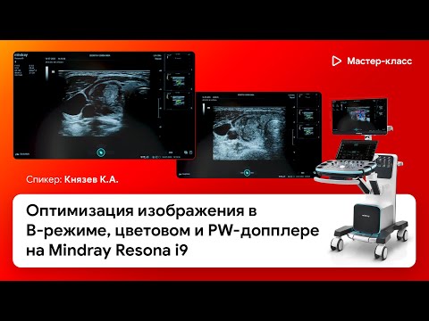 Видео: Оптимизация изображения в B-режиме, цветовом и PW-допплере на Mindray Resona i9