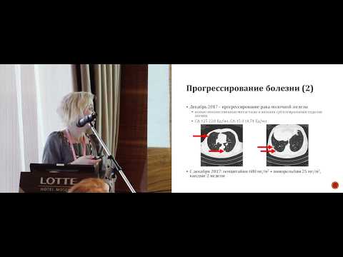 Видео: Клинический случай лечения тройного негативного рака молочной железы с мутацией BRCA1