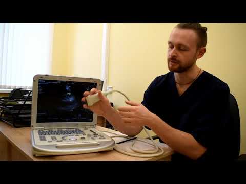 Видео: Панель управления УЗИ-аппарата