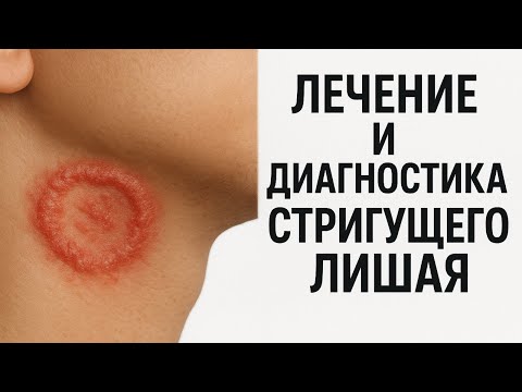 Видео: Стригущий лишай - микроспории! Как распознать и избавиться!