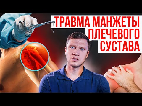 Видео: Травма манжеты плечевого сустава. Травматолог-ортопед Евгений Гончаров