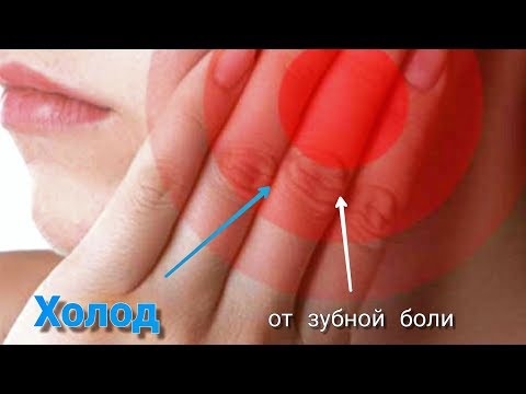 Видео: Холод Помогает От Зубной Боли. Механизм Действия.