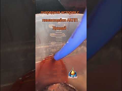 Видео: Ещё одна история про пинающейся АКПП Хундай 
