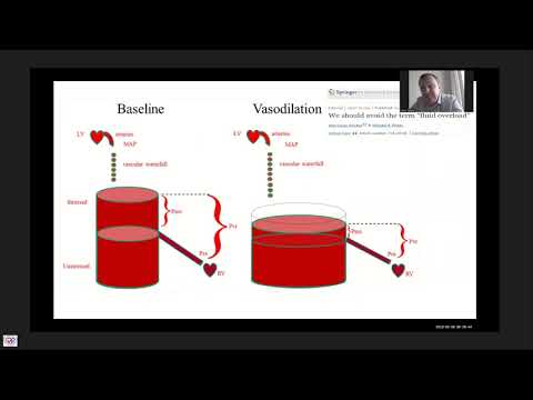 Видео: Объемная реанимация при сепсисе Симутис И.С.