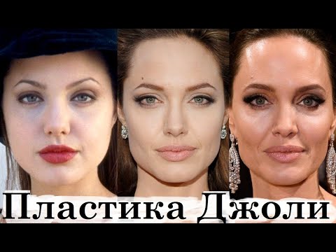 Видео: Неидеальная Анджелина Джоли - Пластика и косметология (2021)