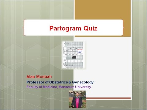 Видео: Тест по партограмме