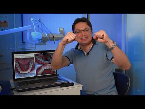 Видео: III часть Тотальное протезирование пациента с двусторонним артрозом ВНЧС