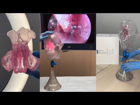 Видео: Техника эндоскопического осмотра компонентов модели ЛОР-органов "Институт ЛОР - Технологий" SUB