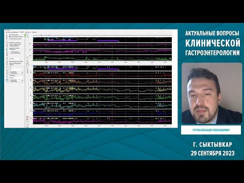 Видео: Гнутов А.А. Эффективность комбинированной терапии ГЭРБ у пациентов с билиарной патологией