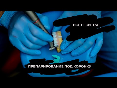 Видео: ПРЕПАРИРОВАНИЕ ПОД КОРОНКУ(все секреты препа)
