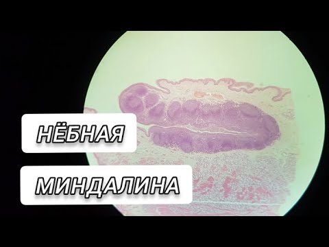 Видео: НЁБНАЯ МИНДАЛИНА