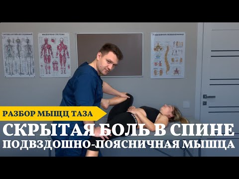 Видео: Скрытая причина боли в пояснице. Подвздошно-поясничная мышца | Кочетков Владимир