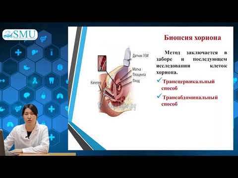 Видео: Методы пренатальной диагностики