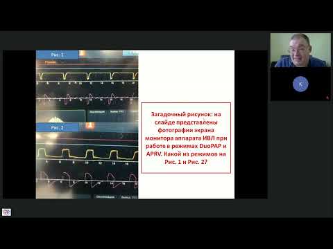 Видео: Изобилие Режимов ИВЛ Афончиков В.С.