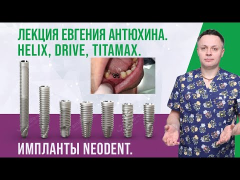 Видео: Имплантаты Neodent Helix Drive Titamax. Евгений Антюхин. Лекция