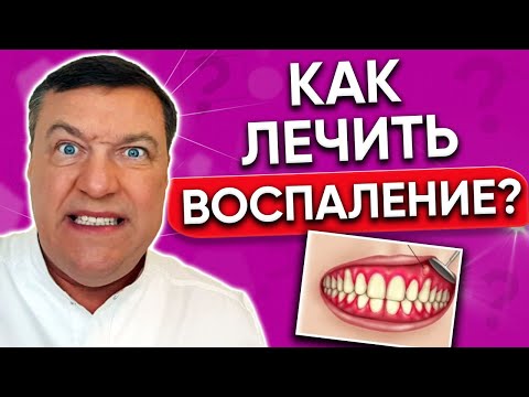 Видео: Как лечить СТОМАТИТ в домашних условиях? ВОСПАЛЕНИЕ во рту.