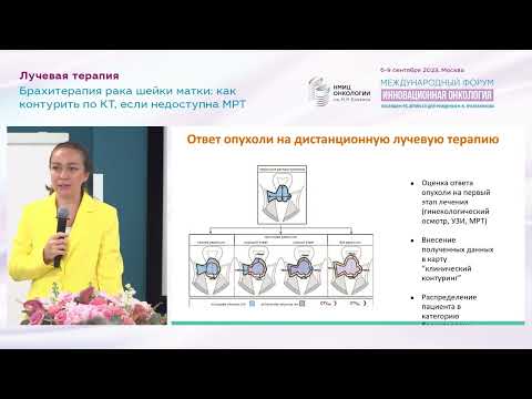 Видео: Брахитерапия рака шейки матки : как контурить по КТ, если недоступна МРТ