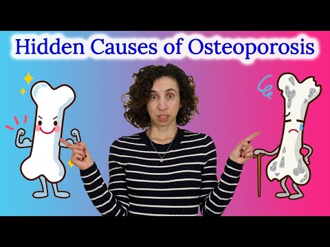 Видео: Что НА САМОМ ДЕЛЕ вызывает остеопороз (шокирующие факторы риска, о которых вы не знали!)